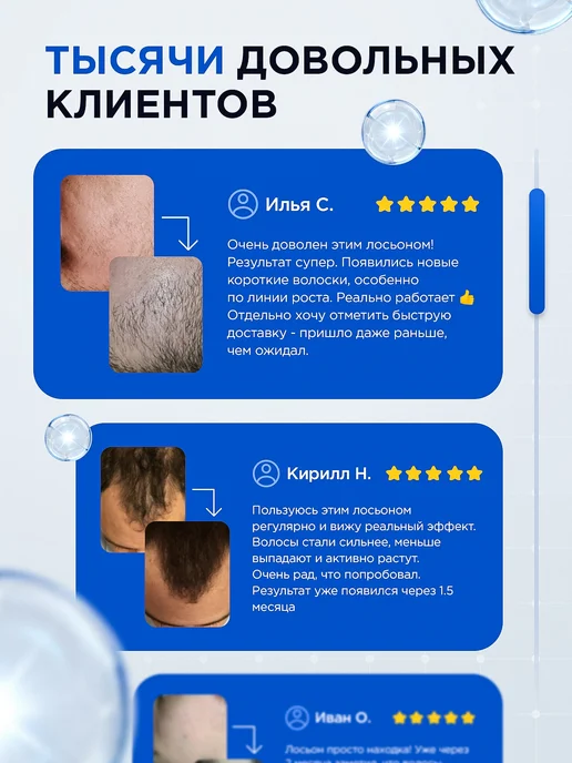 VIKINORD Бустер 15% для роста бороды + Мезороллер + пипетка Ммноксиди…, 60 мл, фото 7