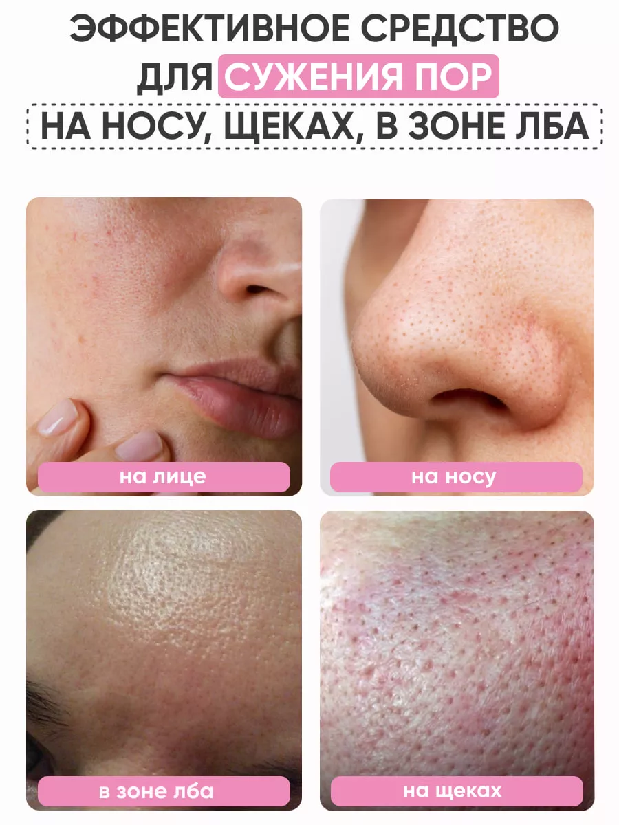 Отзывы о Ciracle Blackhead Off Sheet | virtuoz-salon.ru