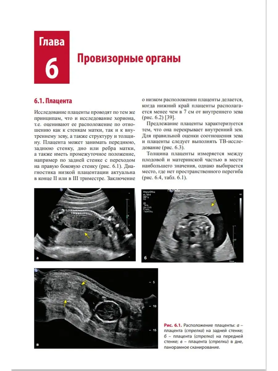 Руководство по ультразвуковой диагностике в акушерстве МЕДпресс-информ  33685321 купить в интернет-магазине Wildberries