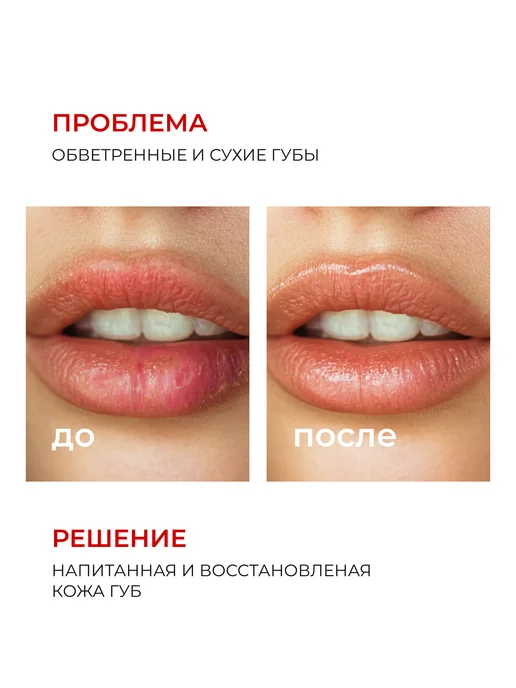 AEVIТ Бальзам для губ Аевит восстанавливающая, белый, фото 2