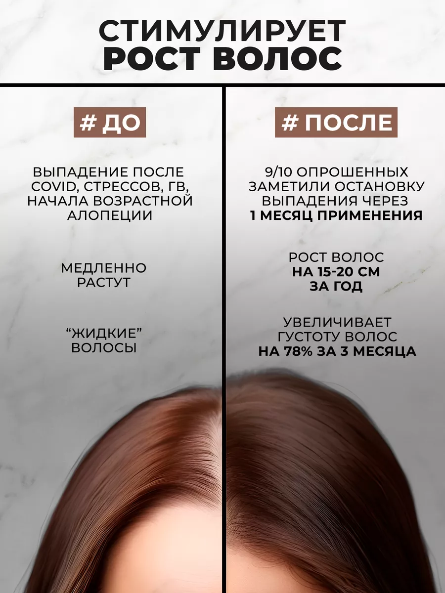 Сыворотка против выпадения волос Prosto Cosmetics 34253042 купить за 1 343  ₽ в интернет-магазине Wildberries