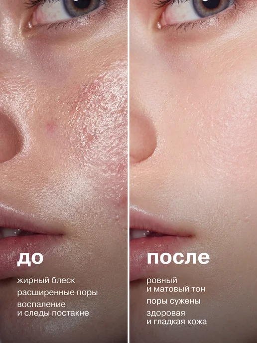 LIBREDERM Лосьон тоник для жирной кожи лица Серацин 200 мл, 200 мл, фото 5