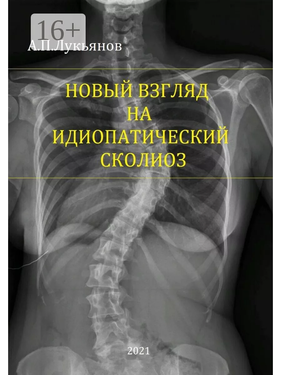 Новый взгляд на идиопатический сколиоз 35458724 купить за 754 ₽ в  интернет-магазине Wildberries