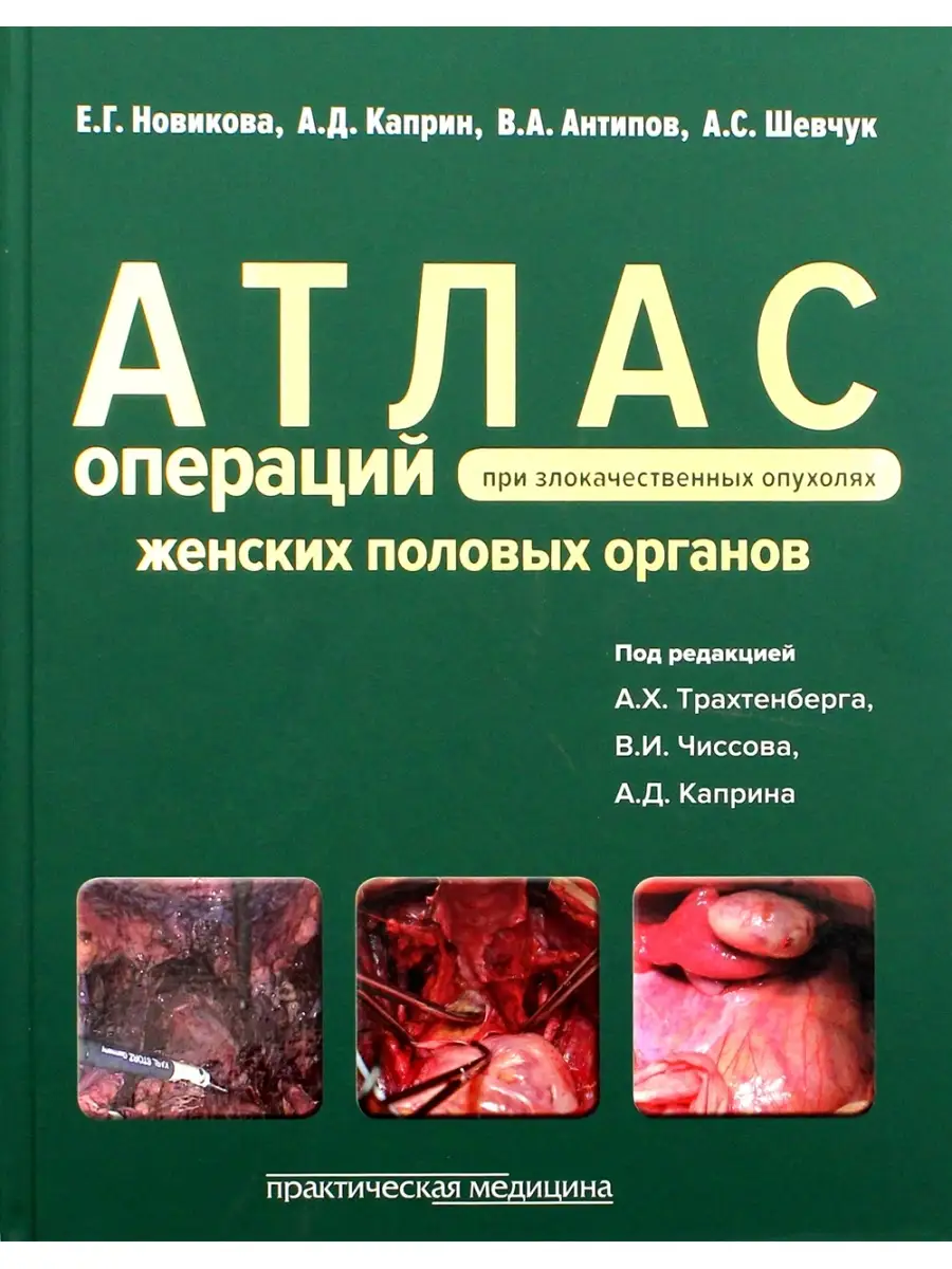 Анатомия женских половых органов - Центр лапароскопии в Москве