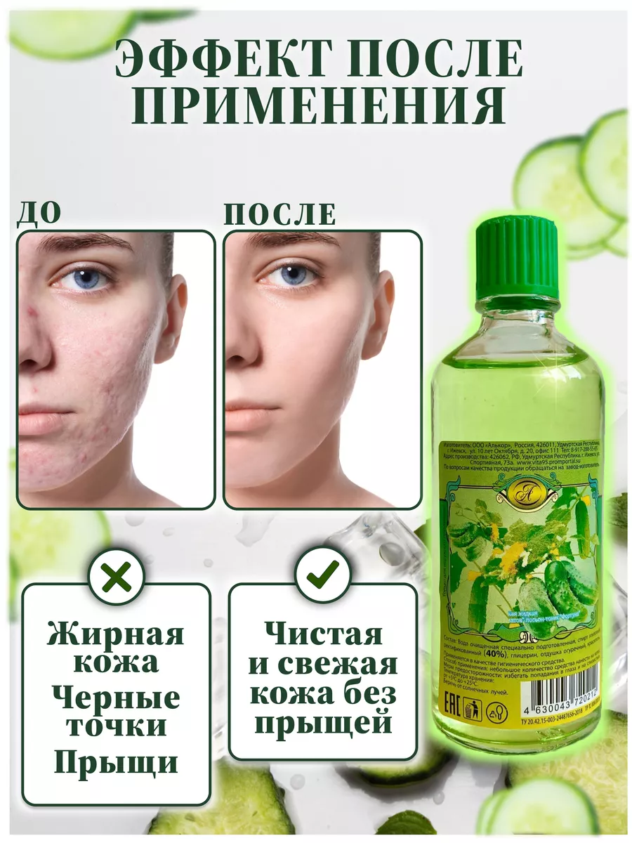 Лосьон после бритья WONDERCOSM 37025870 купить в интернет-магазине  Wildberries