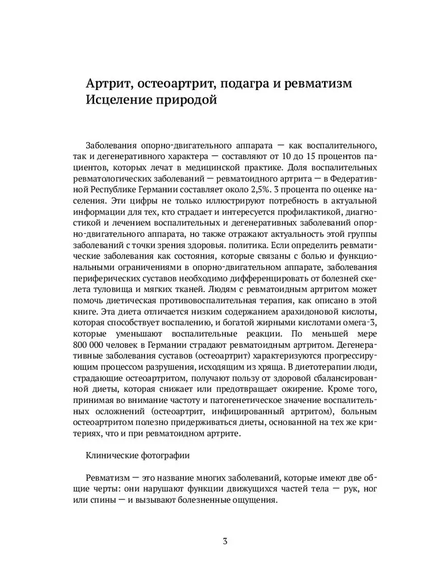 Подагра: лечение, диагностика, профилактика в СПб