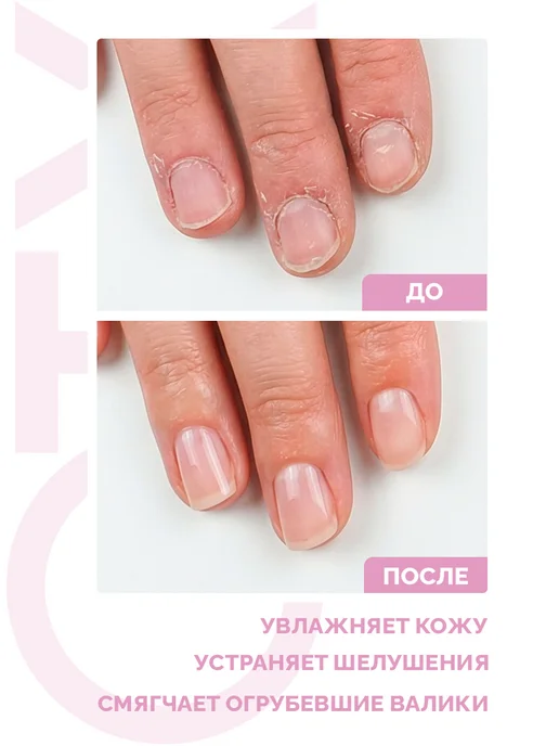 QTiX Ремувер для смягчения и удаления кутикулы, 15 мл, фото 2