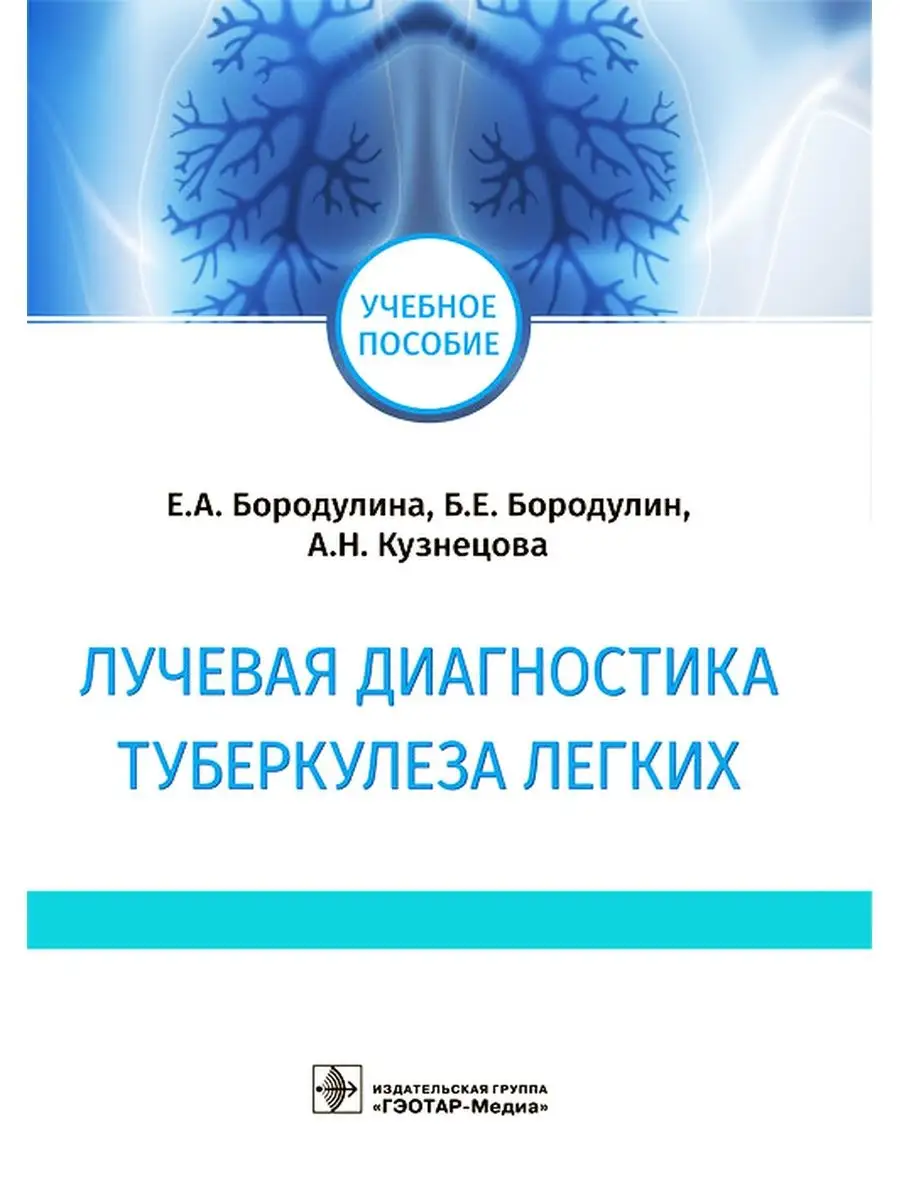 Лучевая диагностика туберкулеза легких ГЭОТАР-Медиа 40761100 купить за 691  ₽ в интернет-магазине Wildberries