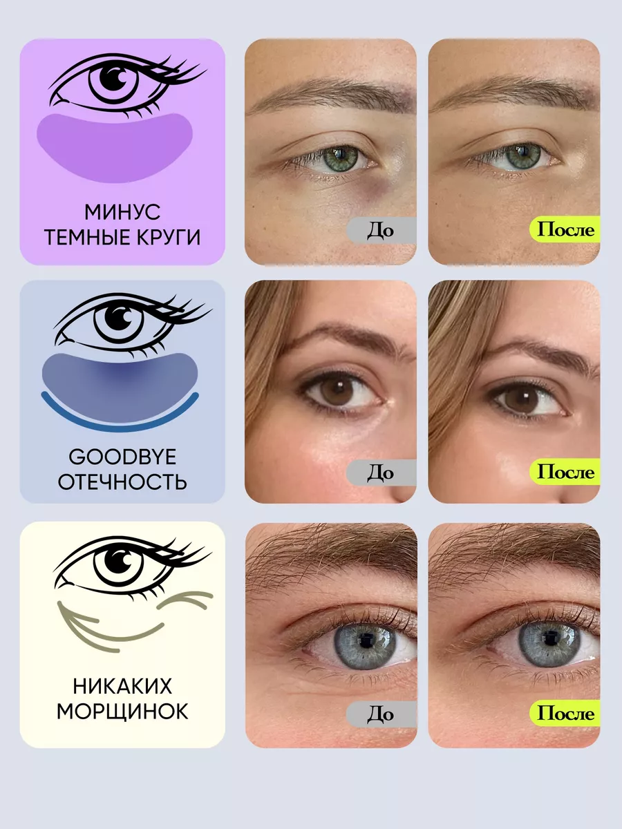 Патчи для глаз от отеков и мешков с коллагеном 80 шт VOIS 41002668 купить  за 252 ₽ в интернет-магазине Wildberries