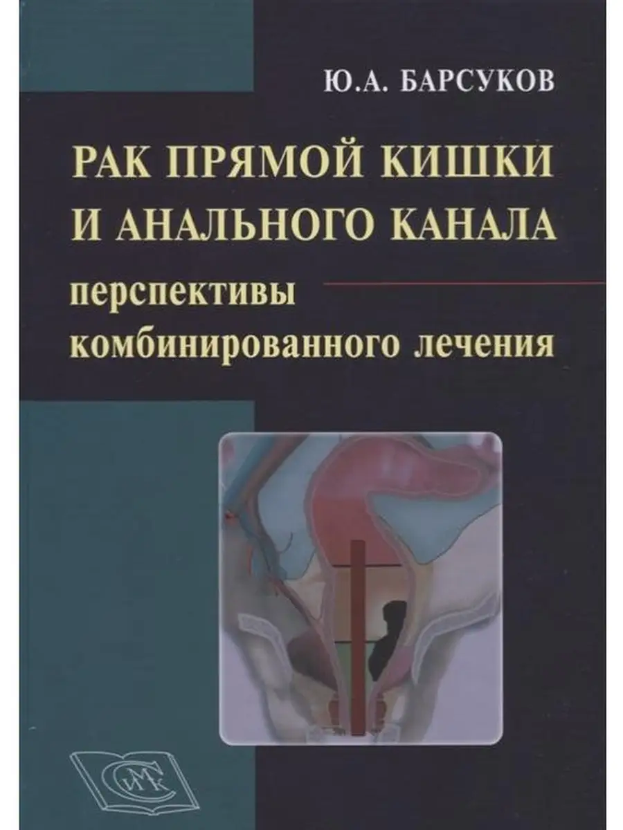 Рак прямой кишки и анального канала: пер Специальное Издательство  Медицинских Книг 41928516 купить за 2 653 ₽ в интернет-магазине Wildberries