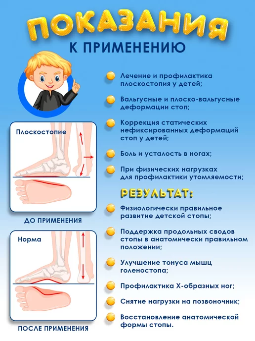 Trives Ортопедические стельки для детей зимние от вальгуса, белый, фото 5