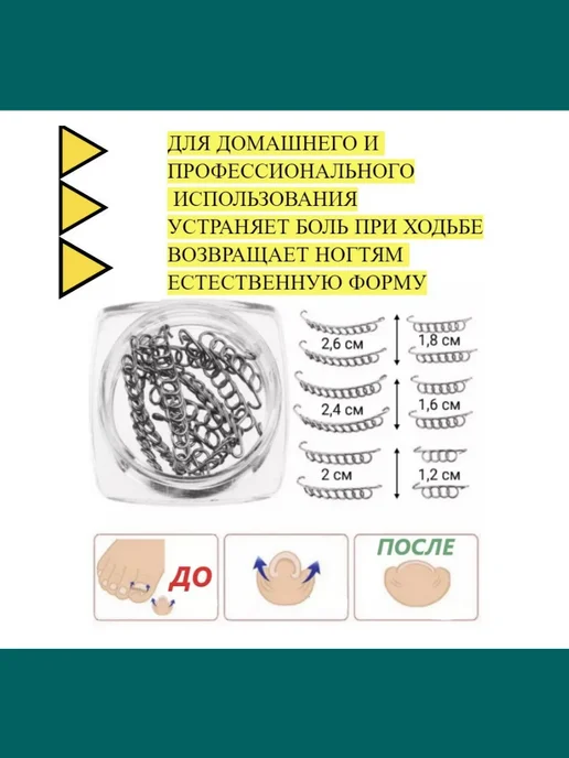 HONS MEDICAL Корректор вросшего ногтя в домашних условиях, серый, фото 2