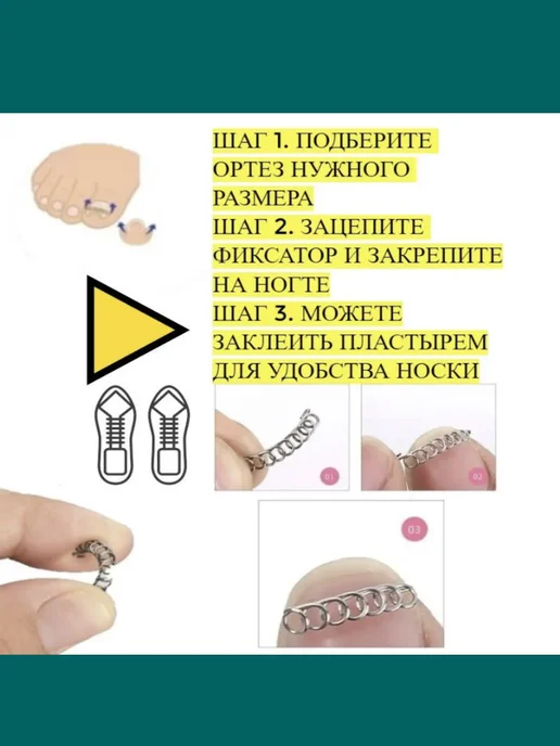 HONS MEDICAL Корректор вросшего ногтя в домашних условиях, серый, фото 3